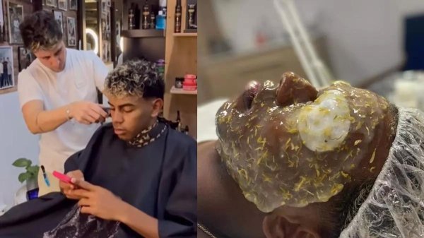 谨慎形象解决，亚马尔采纳了头发守护和痤疮休养